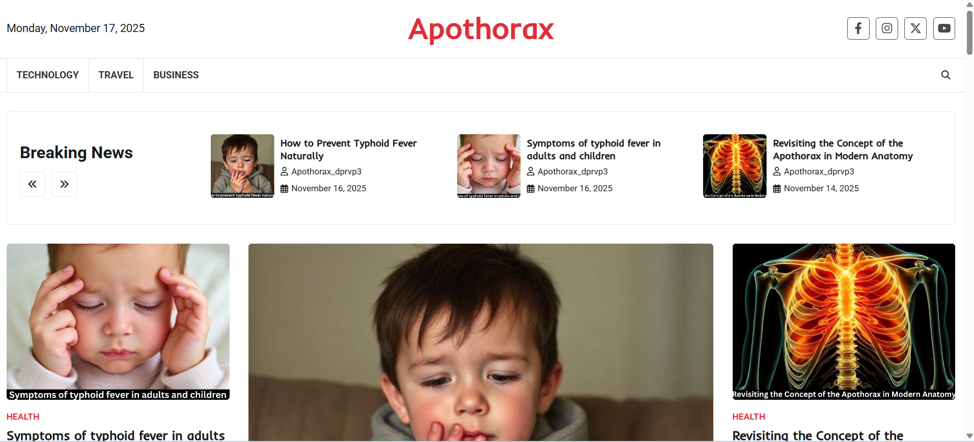 Apothorax: A Forgotten Term in Modern Anatomical Studies